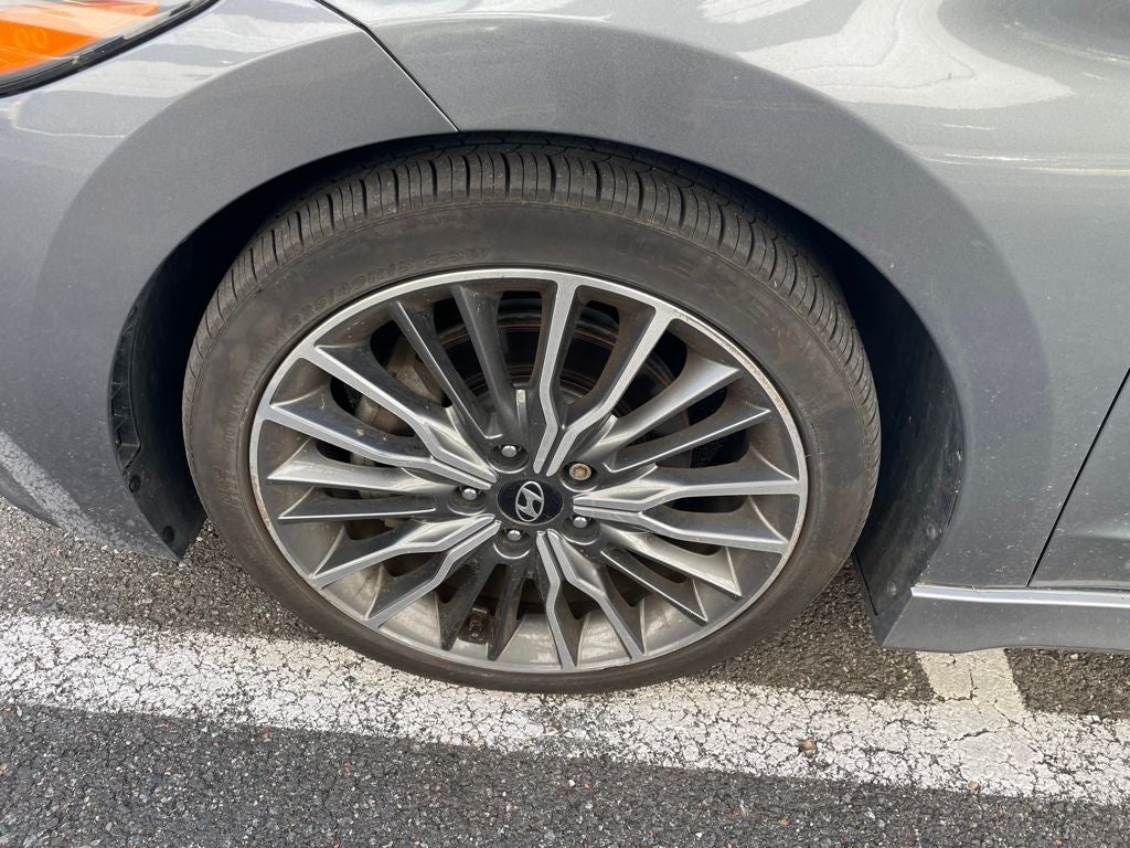 2017 Hyundai Elantra Sport